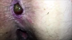 播放 充满水果的肛门拉伸和强烈的爆裂动作